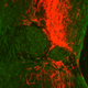 Spinal cords have been re-connected in animals using a number of technologies, and with varying degrees of success.